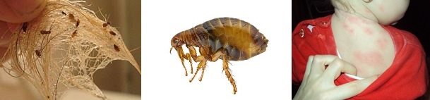Insectele sunt paraziți umani - Care sunt simptomele si semnele teniazei?
